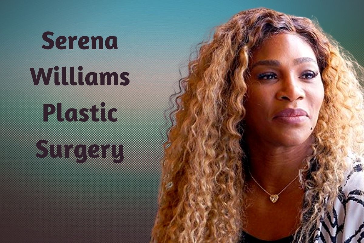 A look at Serena Williams' before and after plastic surgery results